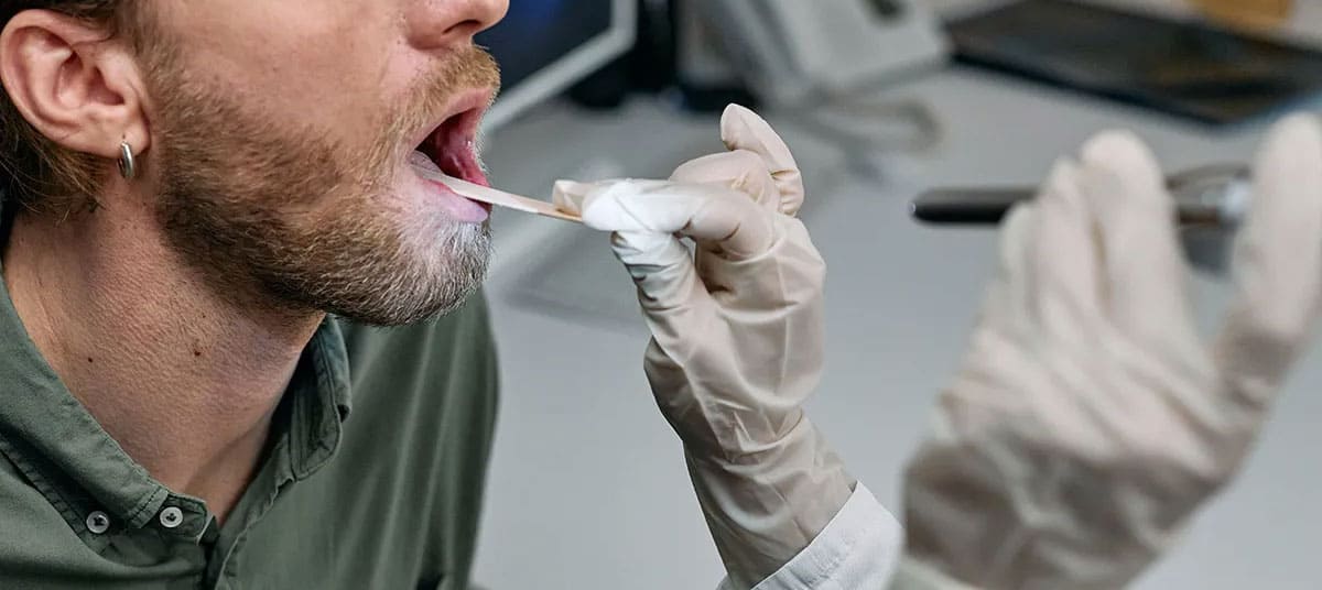 cáncer-de-orofaringe cáncer-de-orofaringe