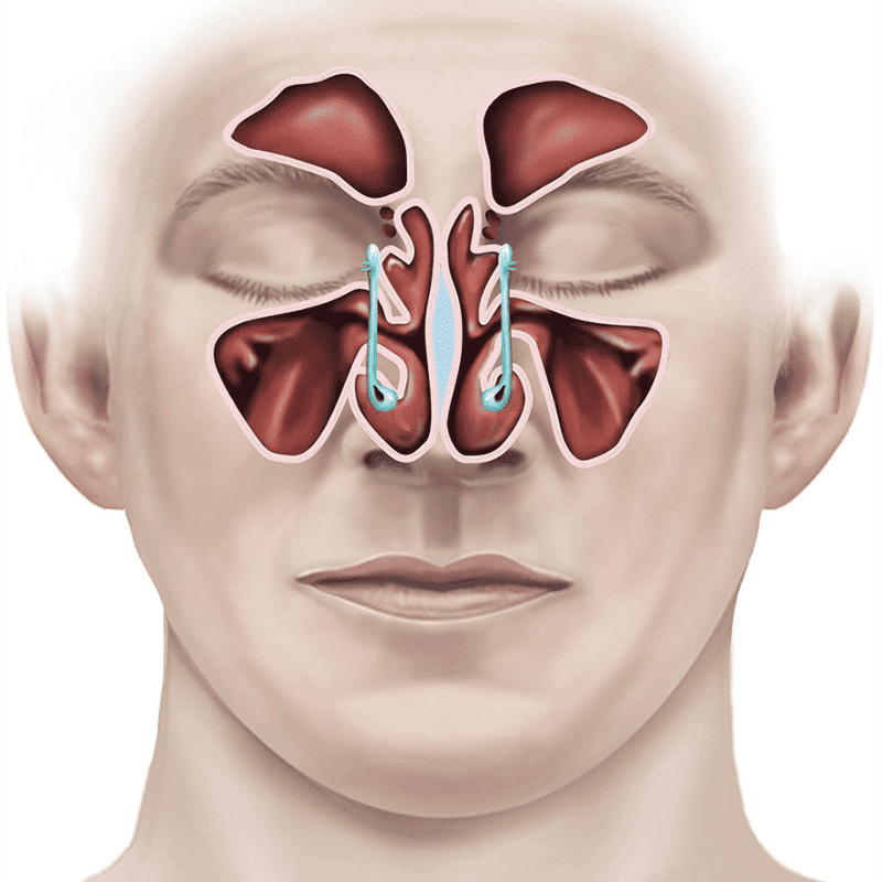 endoscopic-sinus-surgery-illustration-c61add(1)